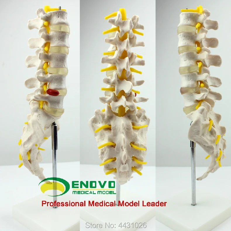 enovo-el-modelo-de-esqueleto-del-disco-intervertebral-modelo-ortopedico