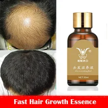 Fast Hair Growth Essence Hair Loss Products Hair Growth Fibras Cabelo Shampoo Cremes De Tratamento Para Cabelos Beauty Hair Care Fast Hair Growth Essence Hair Loss Products Hair Growth Fibras Cabelo Shampoo Cremes De Tratamento Para Cabelos Beauty Hair Care
