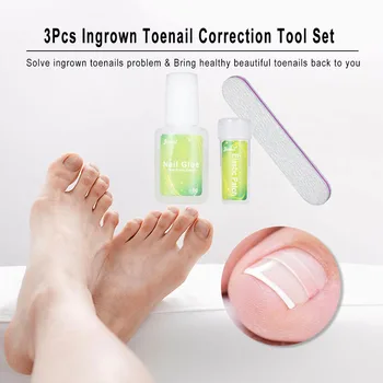 

3pcs/set Ingrown Toenail Correction Tool Set Nail Fixer Pedicure Recover Embed Nail Glue Nail File Plastic Nail Patch