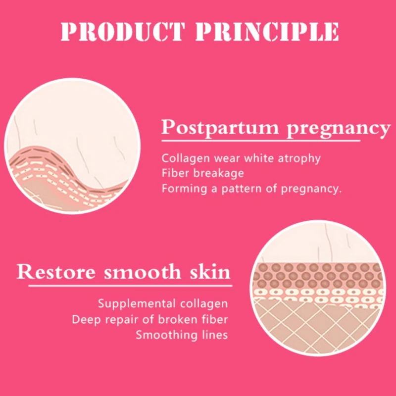 30 мл эфирное масло травяной экстракт беременность шрамы удаление кожи ремонт Эфирное масло