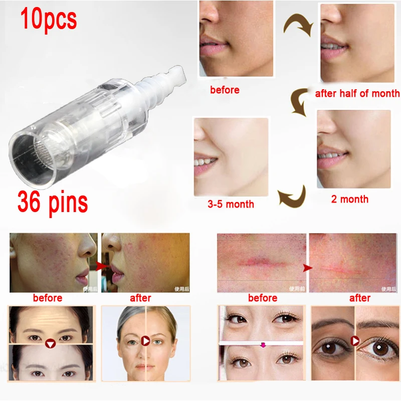 Mezoroller 10 шт. электрическая ручка Derma байонет 36 pin MYM картридж для автомобиля