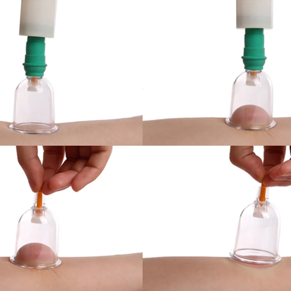 24pcs Vacuum Magnetic Cupping Sets Home Care Medical Thickened Apparatus Traditional Chinese Medicine Medical Therapy  Massage Relaxation (2)