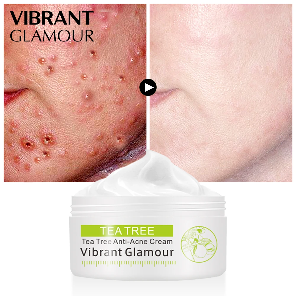 

VIBRANT GLAMOUR Tea Tree Acne Cream Anti-acne Print Face Cream Remover Acne Treatment Facial Eliminates Oil Control Skin Care