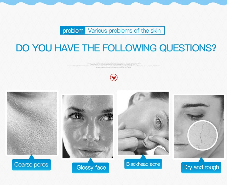 BEOTUA  Shrink Pores Acne Treatment Black Head Remove Oil control Deep Cleansing Foam Facial Cleanser