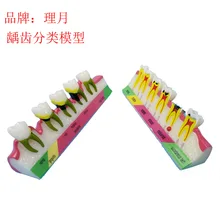 Цветная модель зубов полости рта пародонта модель патологии зубов манекен для медицинского обучения Стоматологическое учебное оборудование