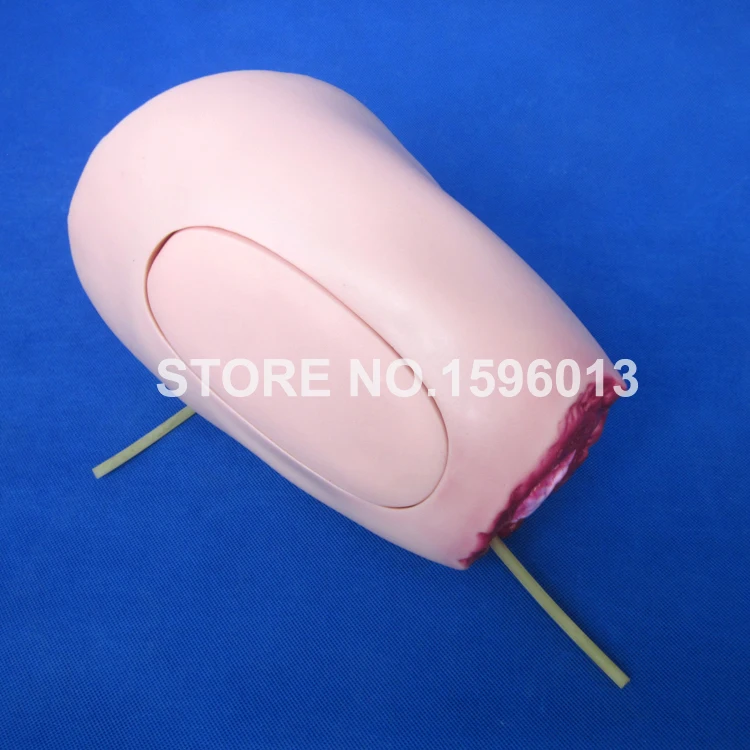 J108-2 amputation (7)