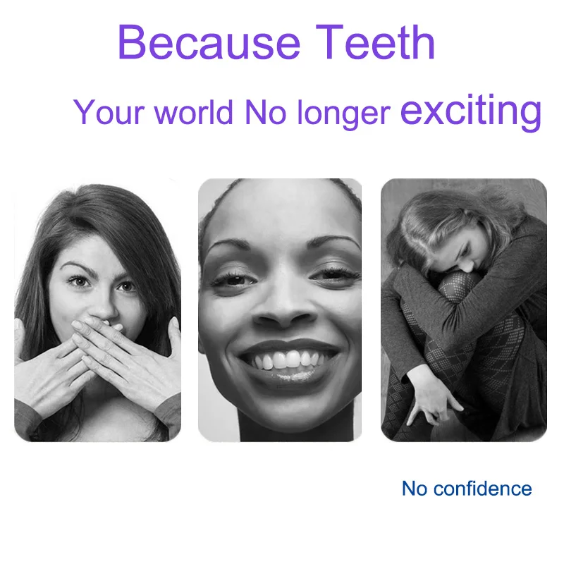Teeth Whitening (7)