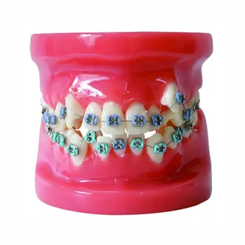 

28pcs Teeth with half metal and half ceramic bracket Dental Tooth Orthodontics Model