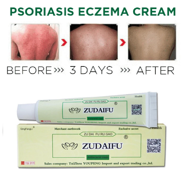 1 piece Hot selling zudaifu Body Psoriasis Cream Psoriasis Ointment