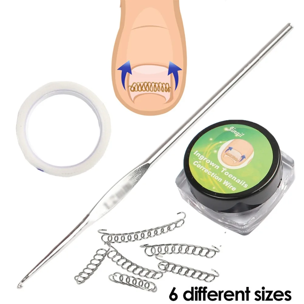 

8pcs/set Ingrown Toe Nail Correction Wire Fixer Pedicure Recover Paronychia Acronyx Onyxis Bunion Corrector Foot Care Tool