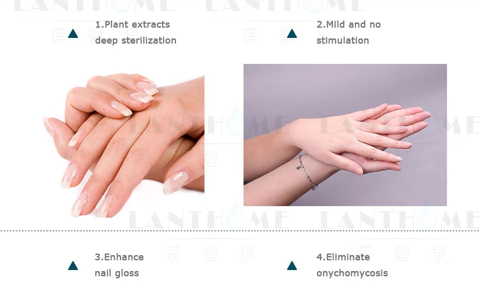 Травяное антибактериальное лечение ногтей onychomicosis Paronychia против грибковой инфекции ногтей, Лечение грибка ногтей, эфирное масло
