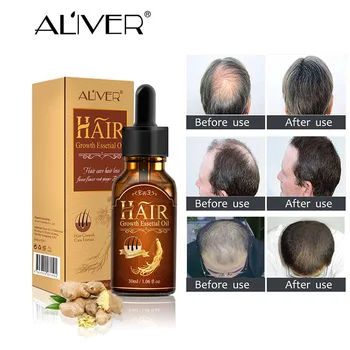 

Hair care essential oil, hair growth liquid, growth and development, hair growth, 30ml