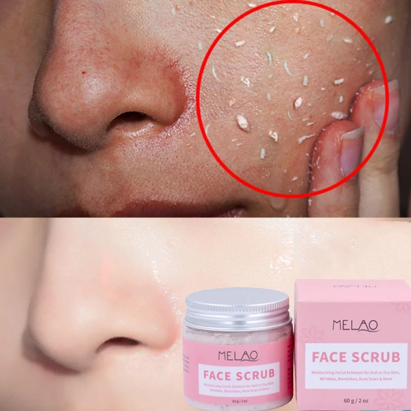 

60g Moisturizing Exfoliate Facial Scrub Wrinkle Blemishe Acne Scars Removing Cream Facial Healthy Skin Care