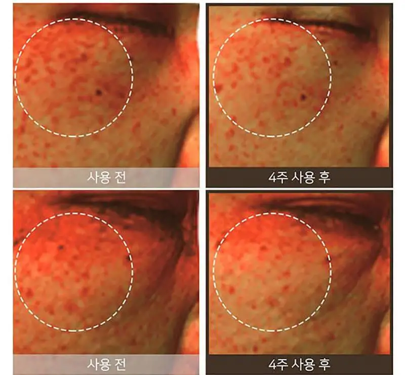 SOME BY mi Galactomyces Pure Vita mi n C светящийся тоник 200 мл отбеливающий тоник Сыворотка для лица тускнеет темные пятна удаление веснушек и черных точек