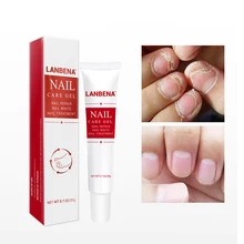 1 шт. травяной крем для восстановления ногтей мощное Лечение грибка для ногтей гель для очистки от грибка