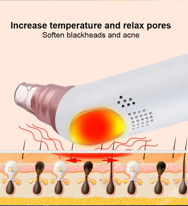 ice cool blackhead removal detail (4)