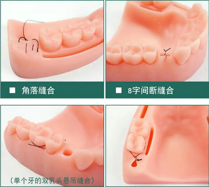 Набор для стоматологической практики, Модель полости рта, игла, набор инструментов для обучения с гелевой моделью для стоматологических студентов
