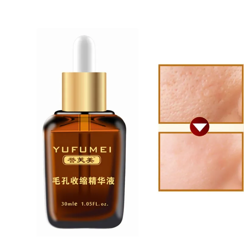 

anti-wrinkle essence Face Care Product Pore Repair Essence Control Oil Blackhead Removal Shrink Pores Essential Liquid A1