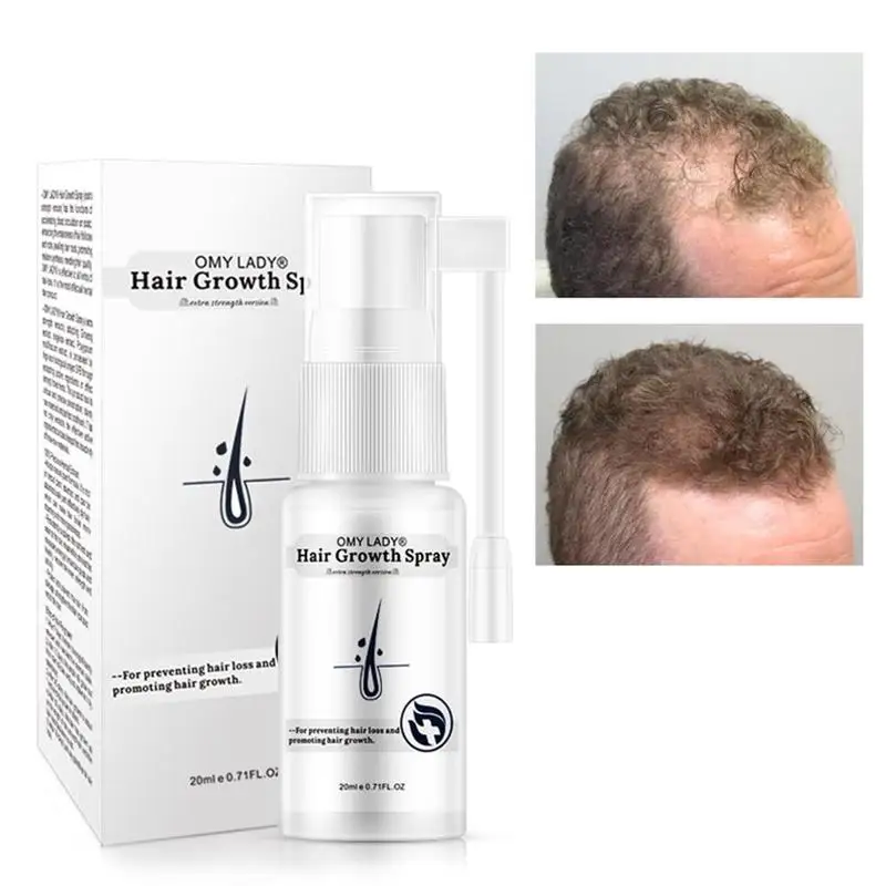 

20ml Hair Care Hair Growth Essential Oil Essence Original Authentic 100% Hair Loss Liquid BODY Care Beauty Dense Hair Growth