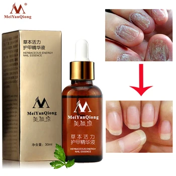 

NEW!!!Fungal Nail Treatment Essence Nail and Foot Whitening Toe Nail Fungus Removal Feet Care Nail Gel Can Drop Shipping