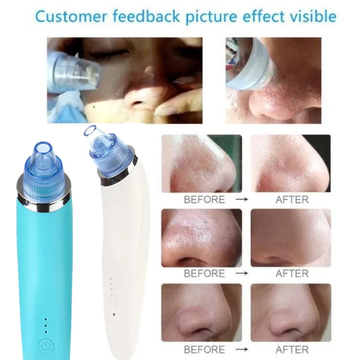 

Diamond Dermabrasion Blackhead Vacuum Cleaner Suction Removal Scar Acne Pore Peeling Face Clean Facial Skin Care Beauty Machine