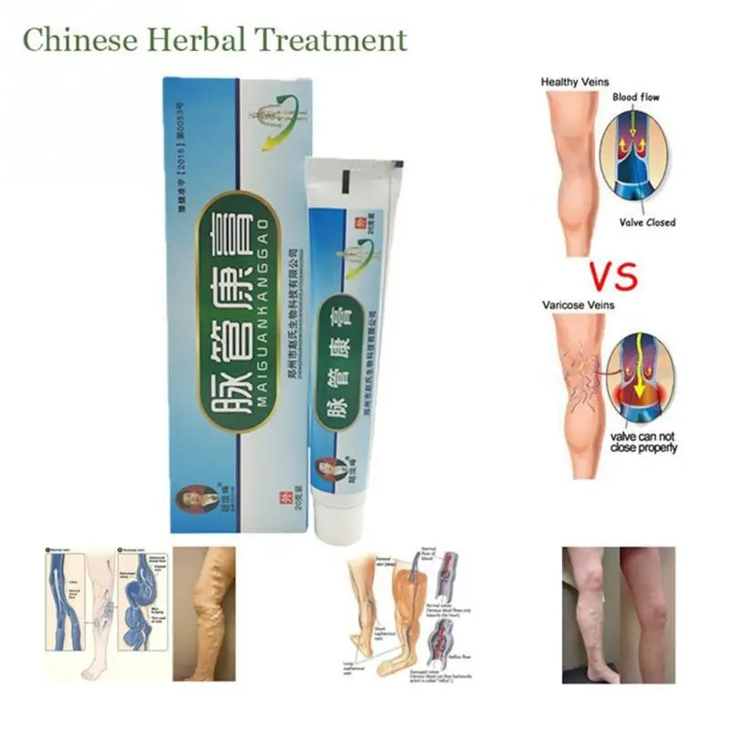 

Varicose Veins ointment vasculitis treatment Phlebitis Angiitis inflammation blood vessel Rotten legs Varicose Veins Cream
