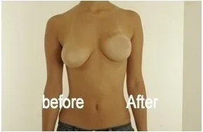 tape for breast cleavage