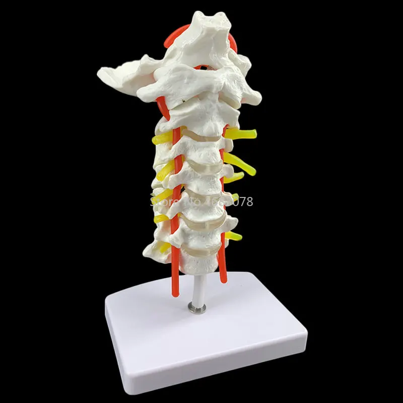 Анатомическая модель человека Шейная модель позвонка шейного отдела позвоночника с шейной артерии затылочный костный диск и модель нерва 18x13x8 cm