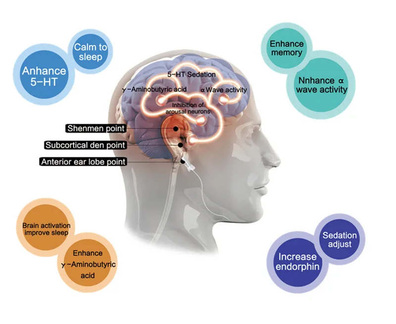 Новая терапия CES транскраниальный стимулятор микро-тока устройство для лечения сна устройство для лечения бессонницы тревоги устройство для лечения бессонницы