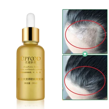 

30ml Liquid Hair Care Anti-Hair Loss Essential Oils Nourishing Beauty Hair Growth Dense Serum Drop Shipping