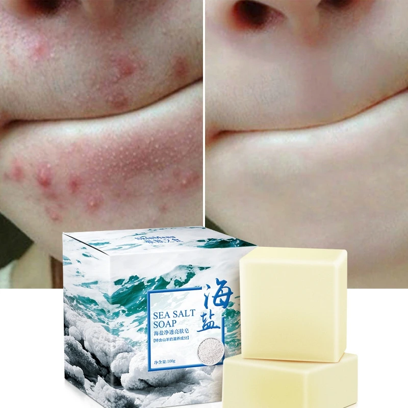 100g Sea Salt Soap Cleaner Removal Pimple Pores Acne Treatment Goat Milk Moisturizing Face Care Wash Basis For Soap Savon Au Hot