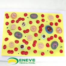 

Medical human blood cell amplification model