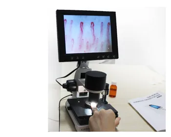 

detector 880 color lcd nailfold capillary USB Digital Microscope blood