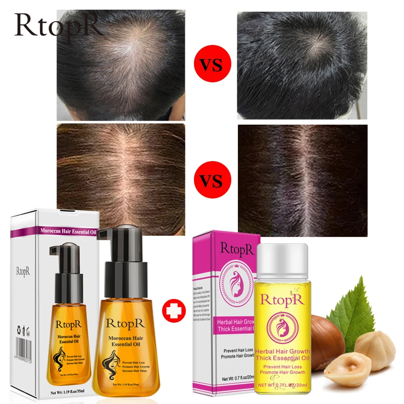 Moroccan Hair Essential Oil Herbal Hair Growth Thick Essential
