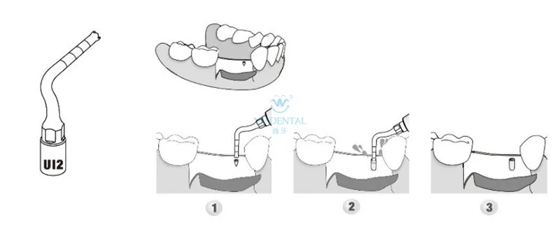 UI2.
