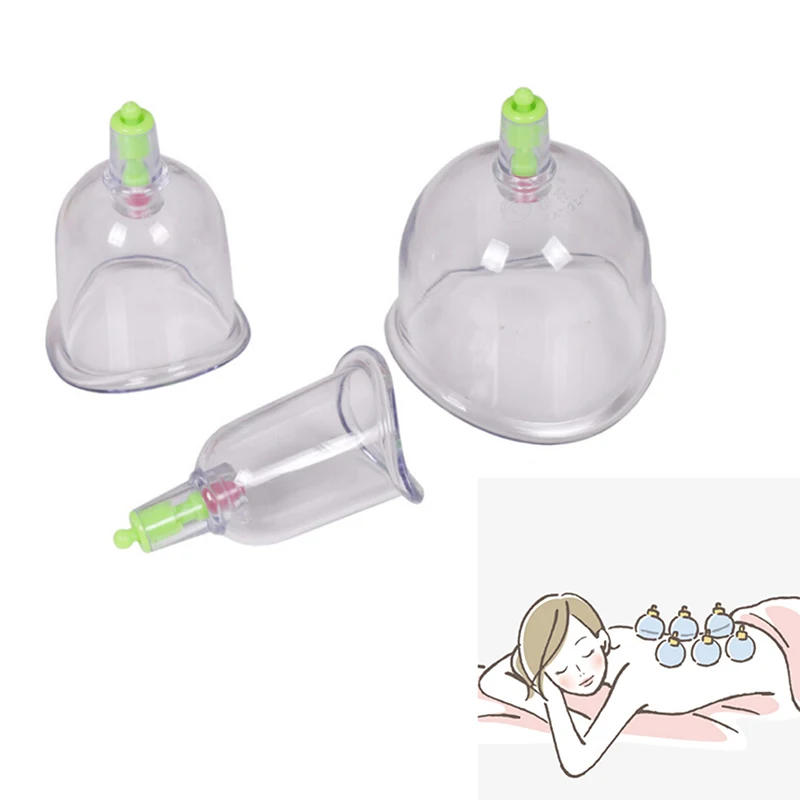 

3 Cups Chinese Cupping Kangzhu U Curved Vacuum Cupping Suction Joint Cupping Therapy Joints Cups Traditional Acupuncture Massage
