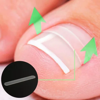 

Paronychia Correction File Elastic Patch Corrector Treatment Tools 10pcs/box Toe Nail Ingrown Correction Sticker Patch Foot Care