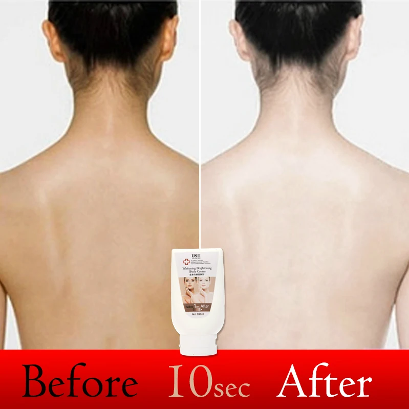 back neck whitening cream