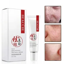 Веснушки крем против морщин для лица пятна темное пятно пигментация кожи отбеливающий крем NShopping