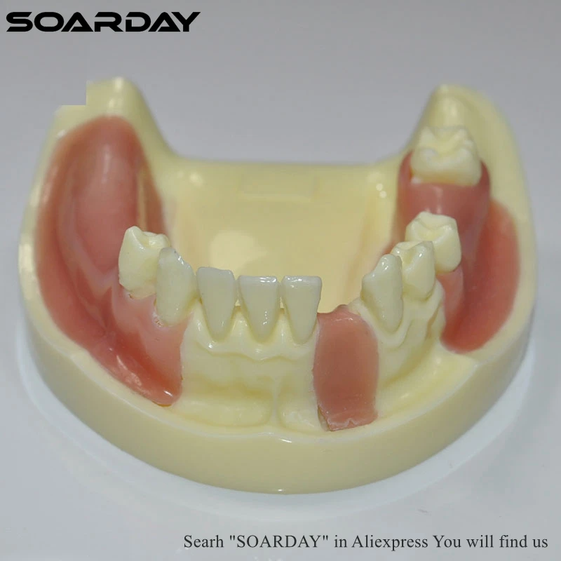 SOARDAY 1 шт. Имплантат практика модель различные зуба отсутствует с имитация кости Структура силиконовые