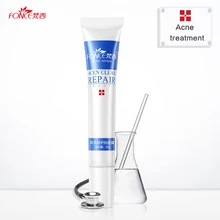 Fonce treatment acne Cream for acne scars mark remover skin lightening Anti Acne face cream whitening to remove dark spots 20g Fonce treatment acne Cream for acne scars mark remover skin lightening Anti Acne face cream whitening to remove dark spots 20g