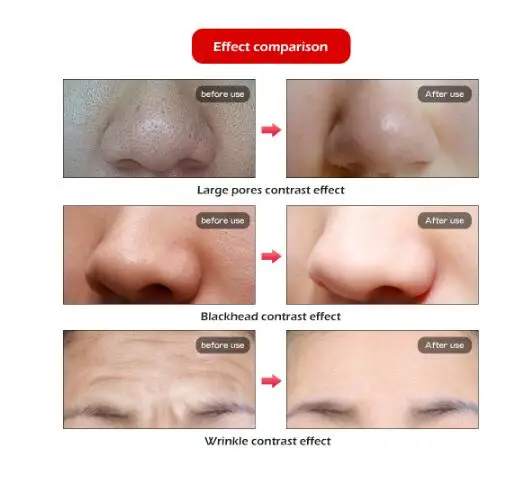  Professional Photon PDT Led Light Facial Mask Machine 7 Colors Acne Treatment Face Whitening Skin R - 4000002486400