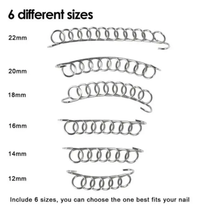 6/12 шт вросшие ногти носок проволочный фиксатор для коррекции ногтей Педикюр Инструменты паронихии восстановить onyxis корректор для большого пальца стопы ног корректор Уход за ногами