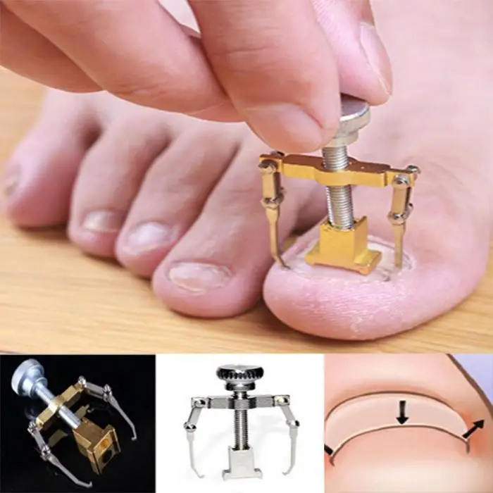 Новый вросший накладные ногти для пальцев ног Коррекция педикюра инструмент ног Уход за ногтями кусачки прибор щипцы для наращивания