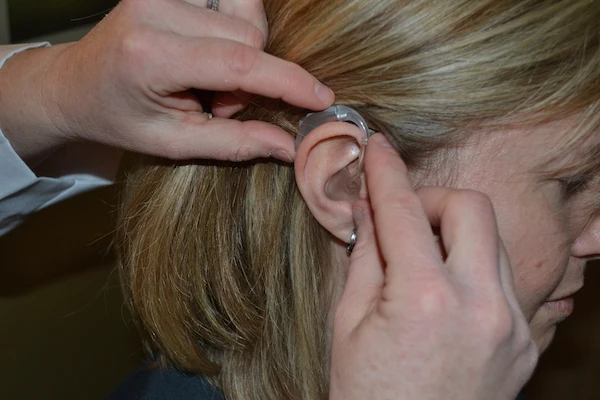 what-are-earmolds