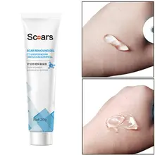 Лечение кожи от угрей крем против акне для удаления шрамов против усадки пор уход за лицом; отбеливание увлажнение