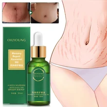 Стретч-Марка восстанавливающее масло для питания кожи быстро удаляет растяжки мама ремонт Эфирное масло