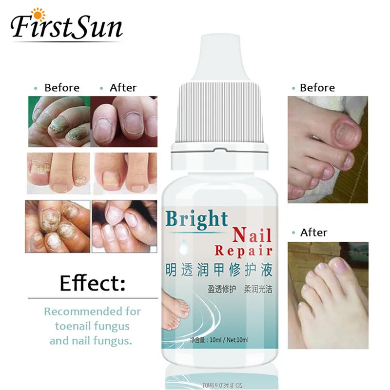 2018 Popular 10ml Nail Treatment Essence Nail and Foot Whitening Toe