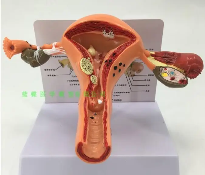 

Pathological changes of uterus and ovary: pathological model of uterus