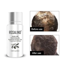 Tratamientos de cuero cabelludo y cabello